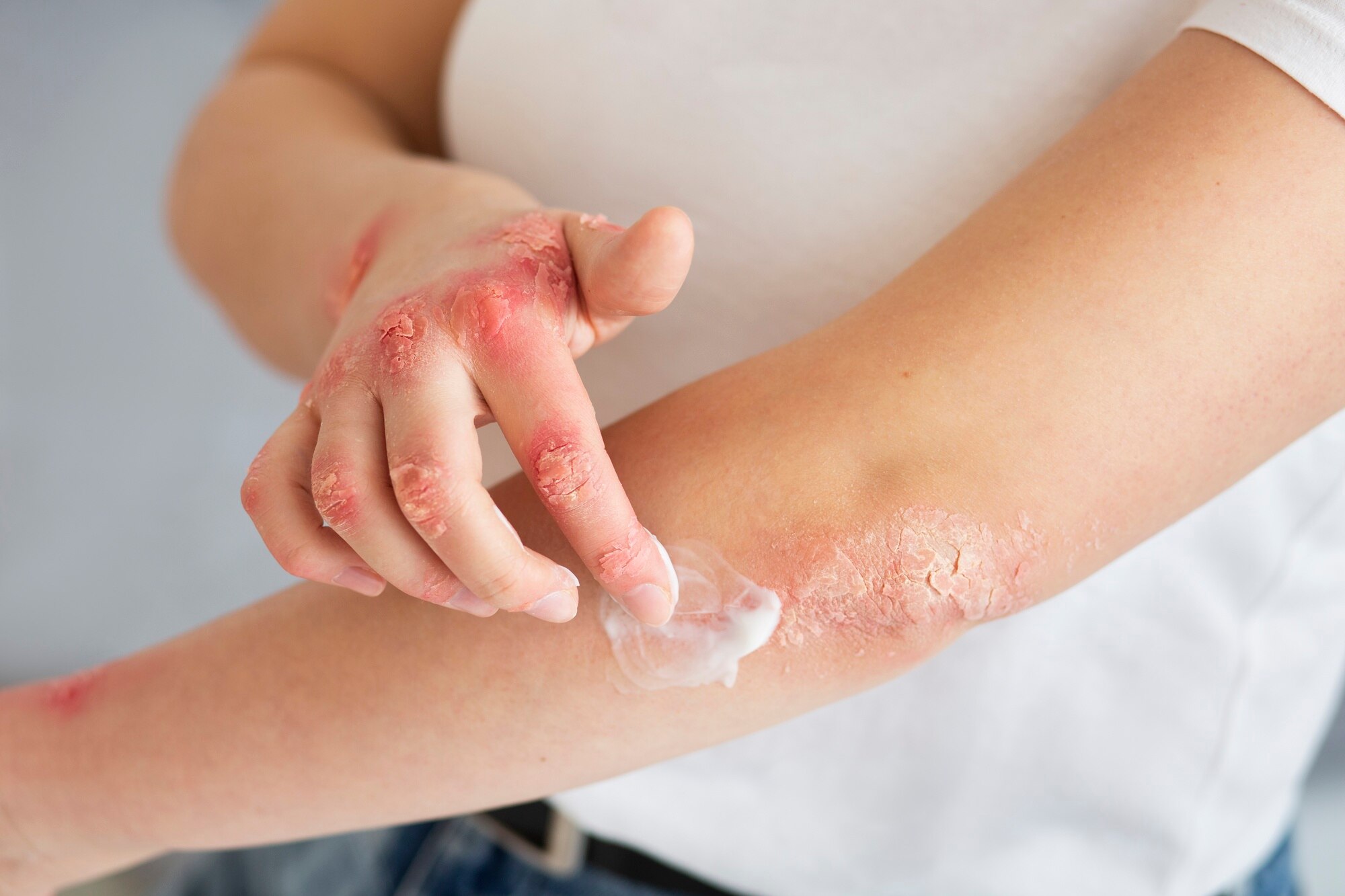 chiropraktik bei allergien